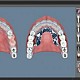 Imagine QDental - software 