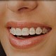 Dentomar SMILE