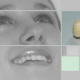 AlmaSan Medicina Dentara Ortodontie 