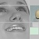 AlmaSan Ortodontie Chirurgie Orala
