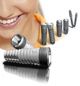 Imagine Promotie implant dentar cu conexiune conometrica
