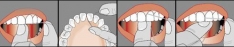 Imagine Folosirea corecta a atei dentare