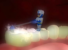 Imagine  Ce inseamna o igiena orala corecta pentru prevenirea aparitiei cariilor dentare?