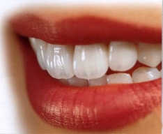 Imagine Ce lucrare dentara sa aleg ?