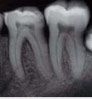 Imagine Radiologia dentara- o alegere fara riscuri