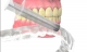 Review la software-ul de stomatologie QDENTAL