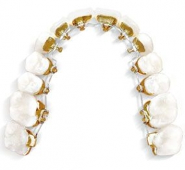 Imagine Aparat Dentar - Magic Dent