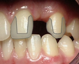 Imagine DentalSib