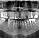 Radiolgie dentara