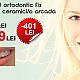 Imagine Oferta aparat dentar ceramic Bucuresti