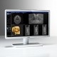 Imagine Monitor medical: BARCO EONIS