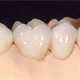 Imagine Estetica dentara- Lucrari protetice