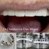 Chirurgie dentara Ploiesti - Dr. Dumitrescu Dan Mugur