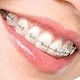 Imagine Consultatie ortodontica gratuita