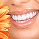 Imagine Oferta 10% la fatete dentare in Otopeni: