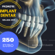 Imagine Oferta inteligenta - implant dentar 250 euro