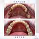 Implant dentar Pitesti - Dr. Radu Dumitru