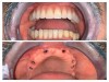Implant dentar Sector 5, Dr. Mina Cristian