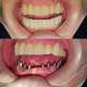 Implant dentar Tulcea – Cristian Medical Dent