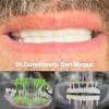 Implant dentar Ploiesti - Dr. Dumitresciu Dan Mugur