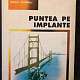 Imagine Carte Puntea pe implante - Dorin Bratu, Walter Fetzer, Emanuel Bratu, Mihai Românu