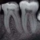 Radiologia dentara- o alegere fara riscuri