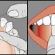 Folosirea corecta a atei dentare