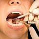Somn la dentist! Un nou tip de tratament ofera speranta celor carora le e frica de dentist!