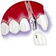 Cosmetic Dentistry