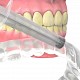 Review la software-ul de stomatologie QDENTAL