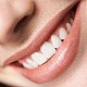 Estetica dentara - fatele - albirea dentara