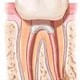 Retratamentul endodontic