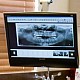 Radiografii dentare digitale: senzori CCD si PSI