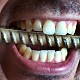 Cum se procedeaza in cazul unei urgente dentare?