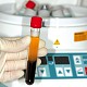 Utilizarea membranelor PRF in stomatologie