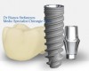 Contraindicatiile implantelor dentare