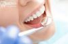 Indiciatii albire dentara