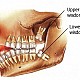 Indicatii post-operatorii dupa interventii chirurgicale oro-dentare!