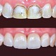 imagine Dr. Benea Diana - Medic Dentist Specialist Protetica Dentara Royal Dent Timisoara