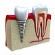 Clinica Lucas Dent (implant Dentar 