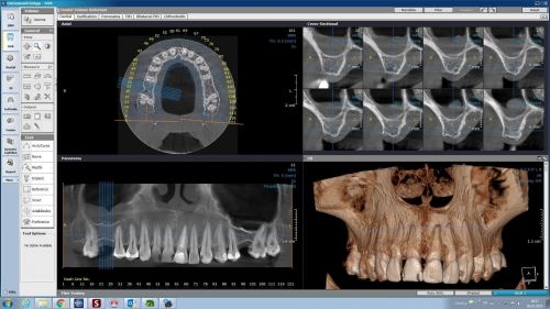 Dental X RAD poza 4