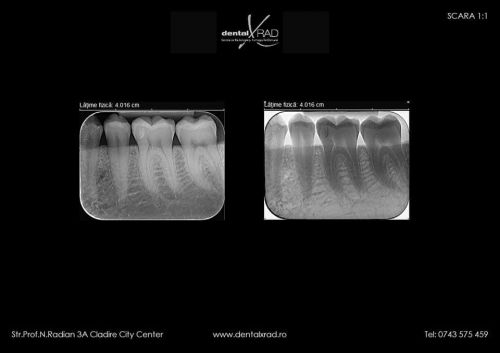 Dental X RAD poza 3