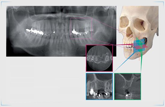 RADIOLOGIA 1 poza 3