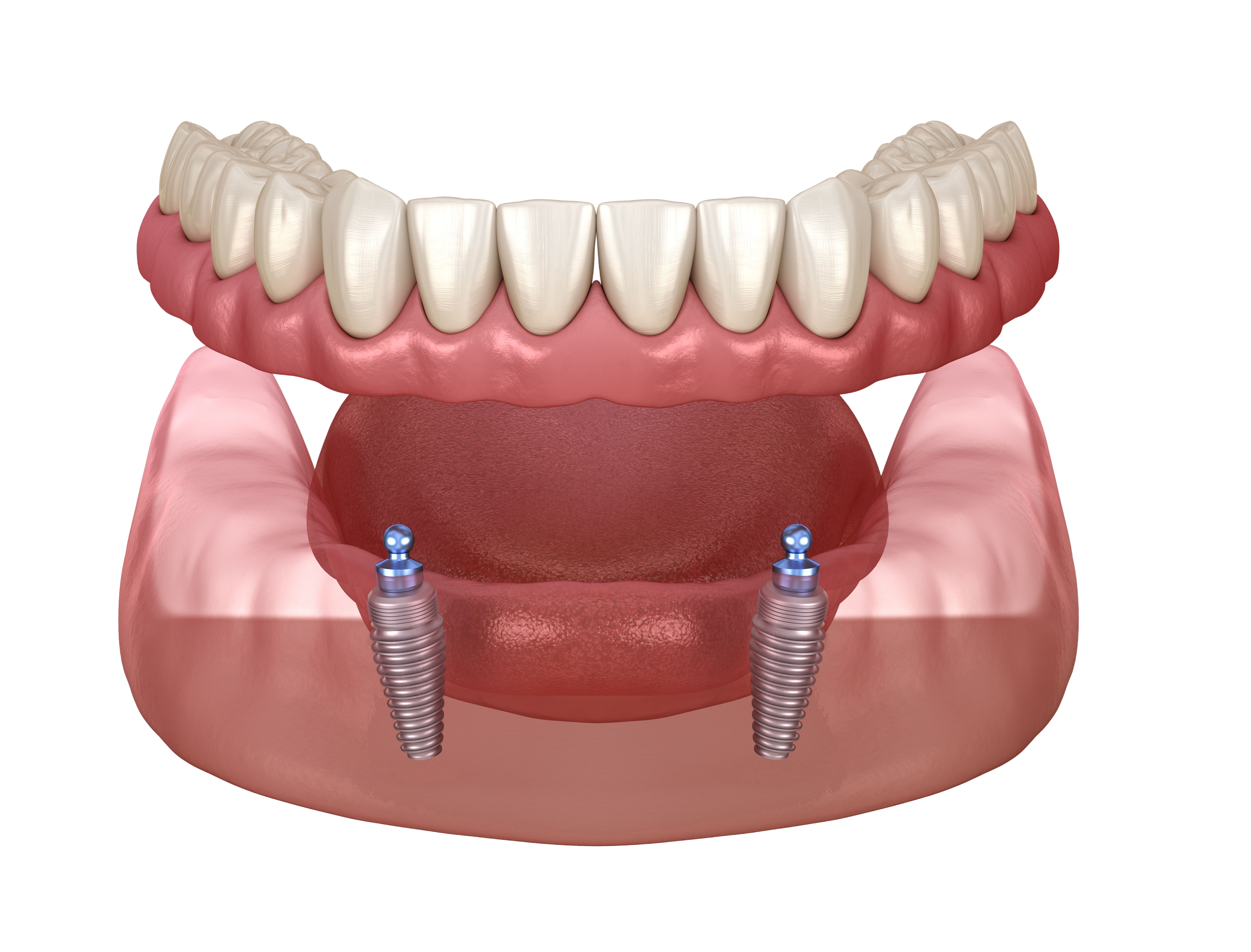 Gold Dental Clinic poza 3