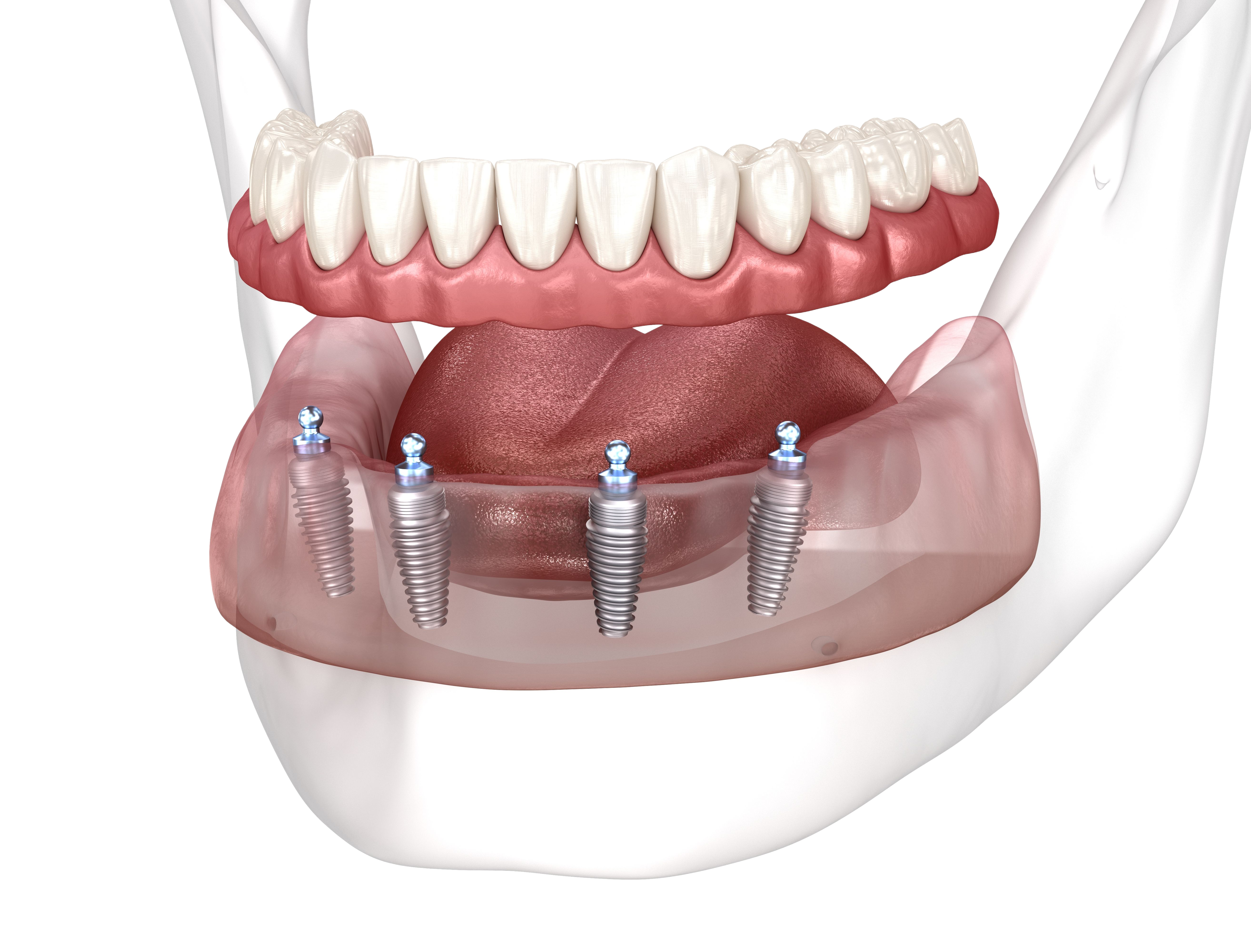 Gold Dental Clinic poza 2