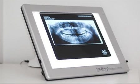 Cabinet de radiologie dentara digitala poza 1