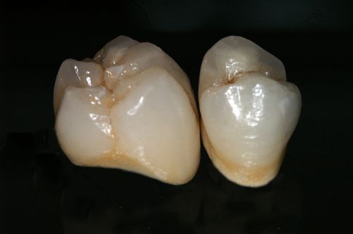 Ceramdent poza 10