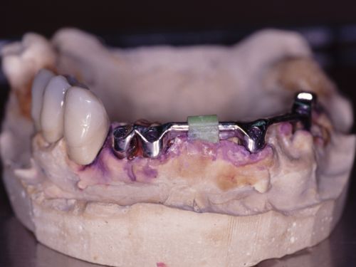 Ceramdent poza 9