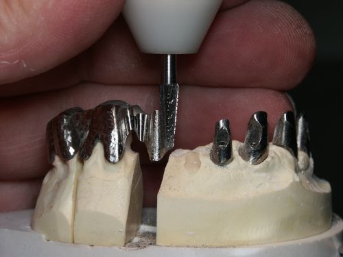 Ceramdent poza 8