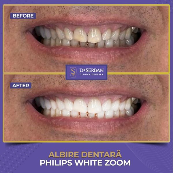 Clinica stomatologică Dr. Serban poza 7